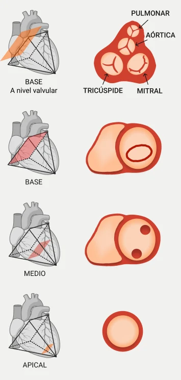 Cortes del corazón a nivel valvular, basal, medio y apical