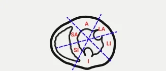 Los seis segmentos: A, SA, SI, I, LI y LA