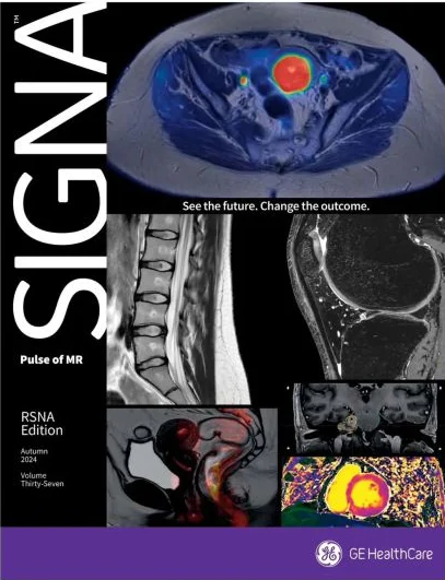 Portada de la edición RSNA de SIGNA Pulse of MR, otoño 2024